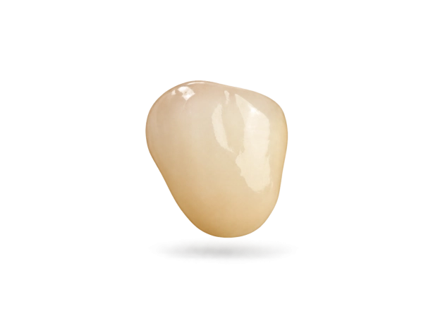 Couronne vitrocéramique IPS E-Max