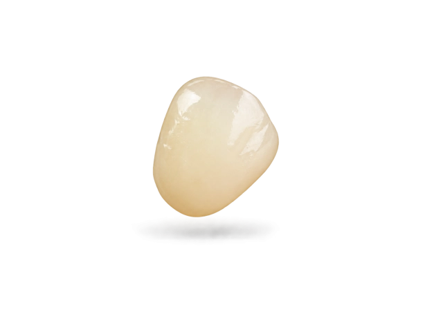 Couronne vitrocéramique IPS E-Max