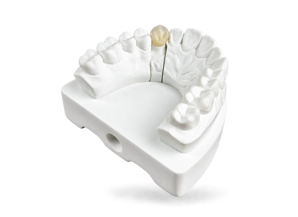 Couronne vitrocéramique IPS E-Max