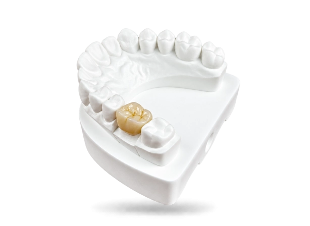 Couronne zircone monolithique sur mesure