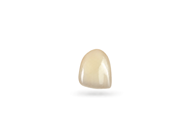 Facette E-max