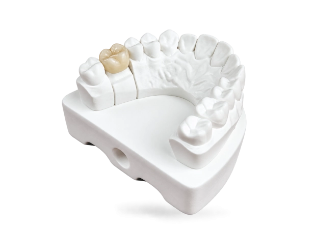Couronne zircone monolithique sur mesure