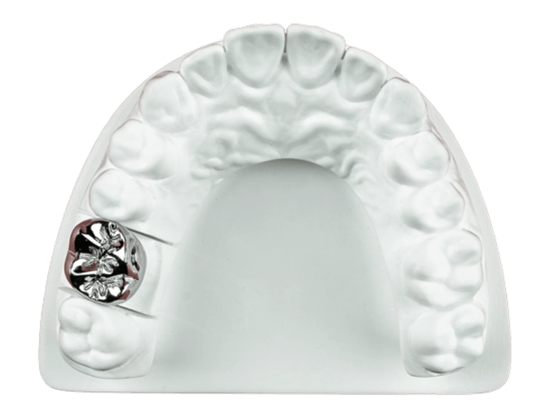 Couronne coulée