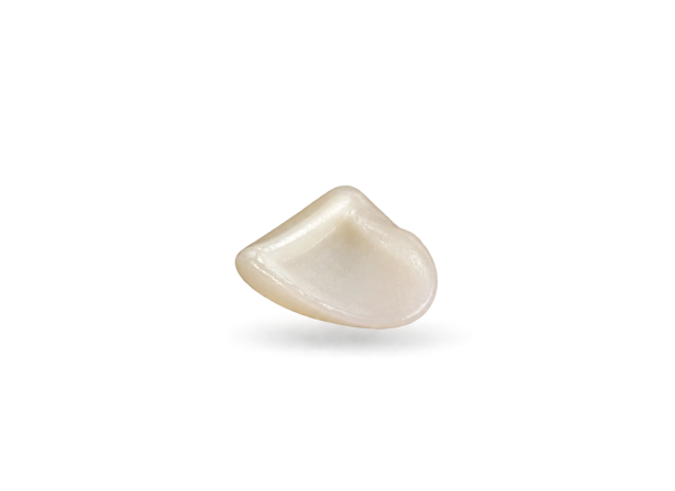 Facette E-max