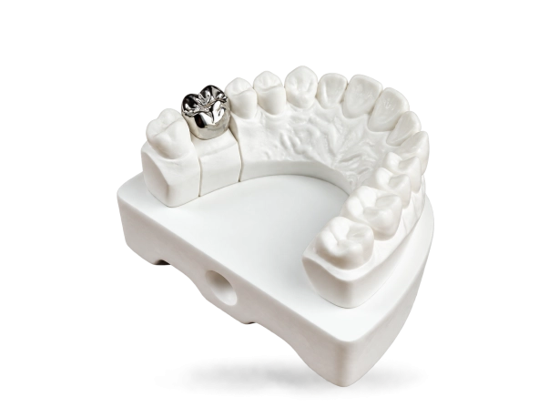 Couronne coulée