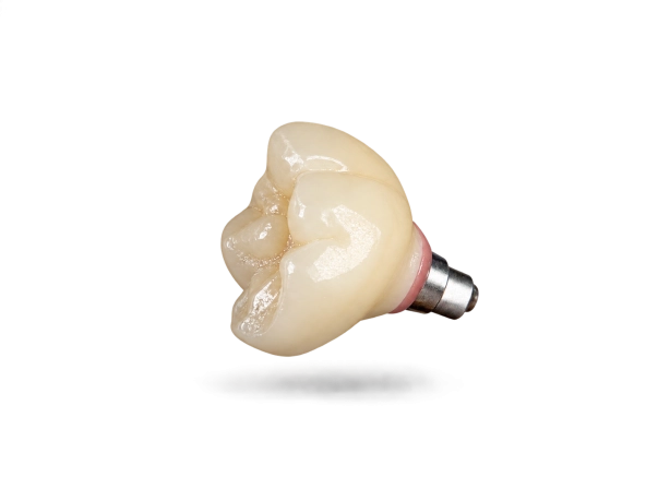 Couronne sur implant transvissée