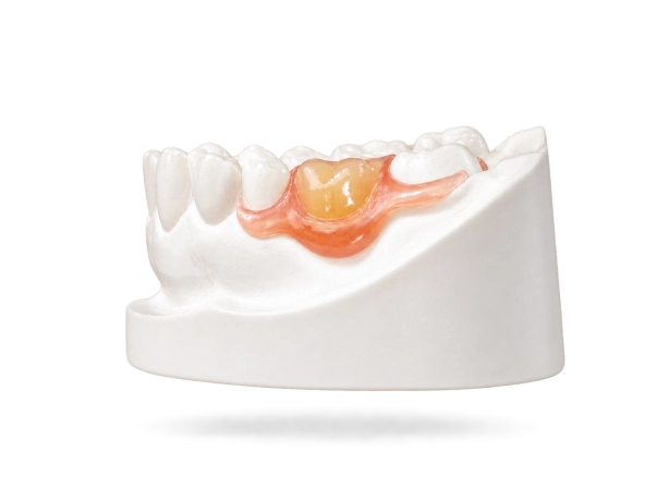 Prothèse Valplast®