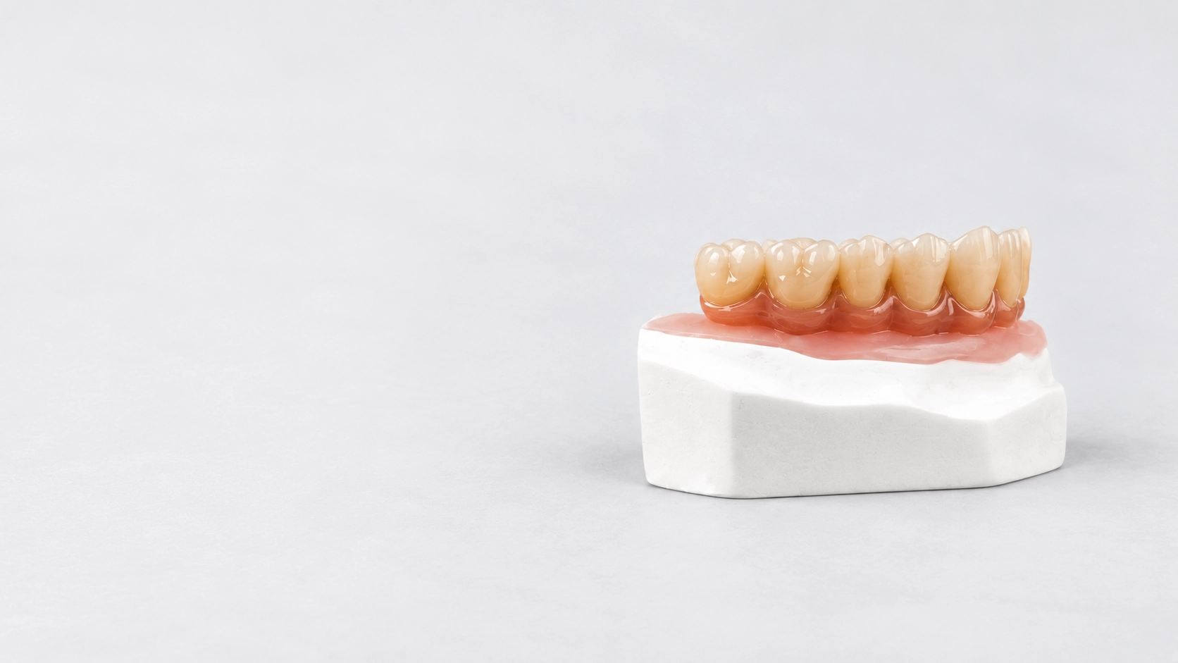 Prothese_dentaire_sur_socle_en_platre_laboratoire_cosmident