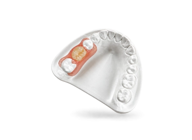 Prothèse Valplast®
